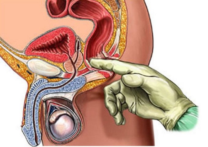 Массаж простаты
