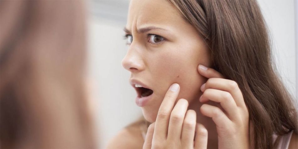Acne on the cheeks before menstruation