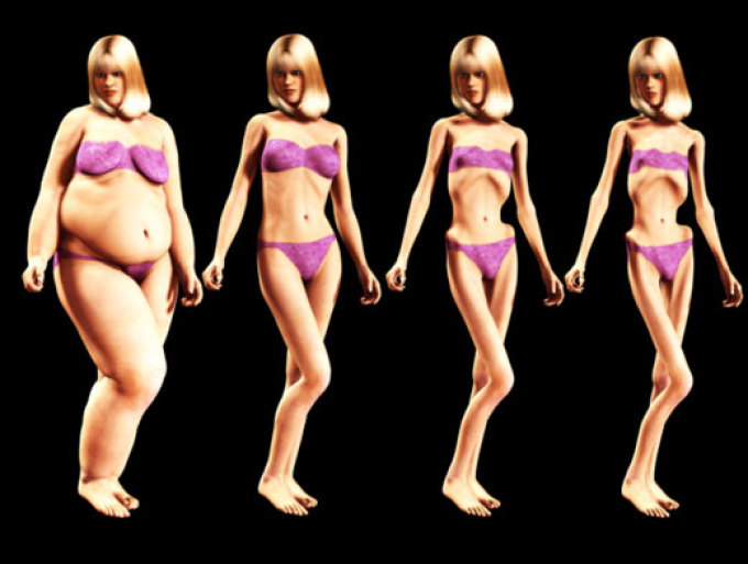 Anoreksija - ne grejte v skrajnosti