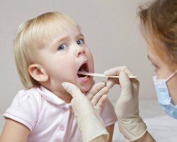 Otroško vneto grlo. Simptomi tonzilitisa pri otrocih? Antibiotiki od tonzilitisa do otrok