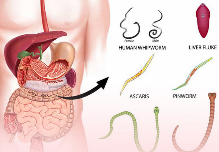 Les parasites intestinaux sont dangereux pour les humains