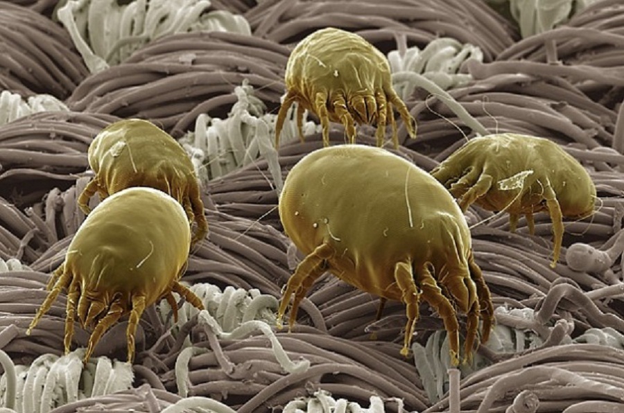 Scabies under the skin