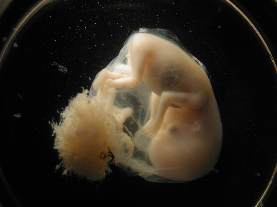 Фото эмбриона 7 8 недель фото