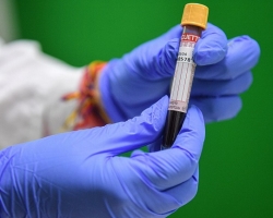 Δοκιμή αίματος για αντισώματα στο Covid-19 για να πάρει ένα άδειο στομάχι ή όχι; Πώς να προετοιμαστείτε για το αίμα σε αντισώματα στον κορώνα;
