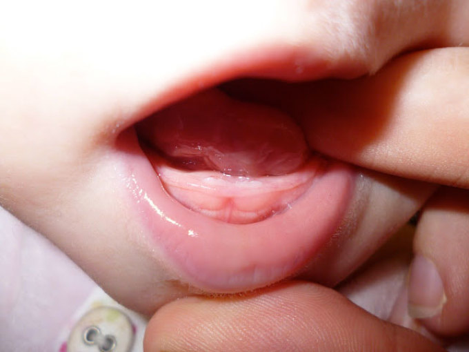 Les premiers dents des enfants