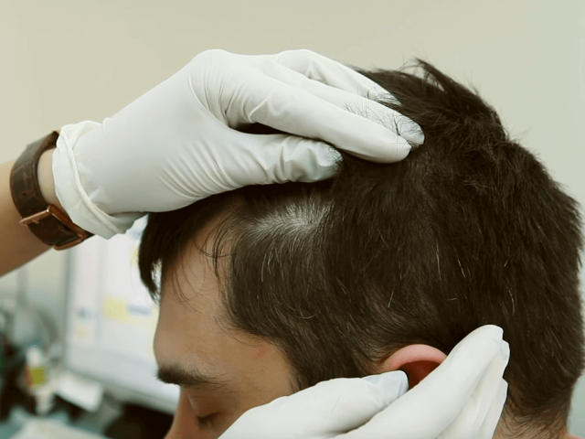 Qual è il rimedio alla forfora più efficace? Dandruff: elenco. Ricette popolari e farmaci da forfora