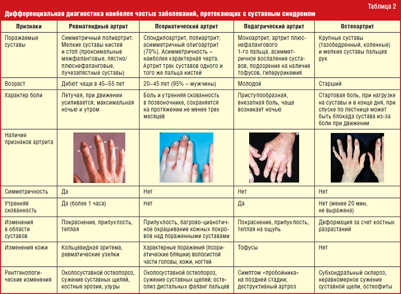 Диагностика артрита пальцев рук