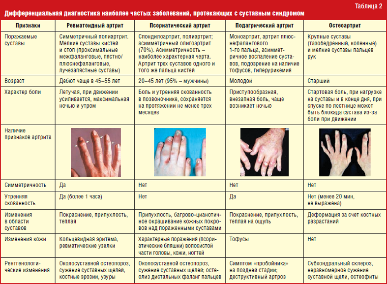 Diagnostika artritídy prstov