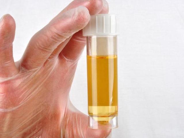 Urin transparan, tidak berwarna pada anak, selama kehamilan, pielonefritis: penyebab. Mengapa urin transparan, seperti air?