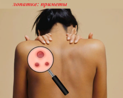 Why the pimple jumped on the back to the right, left, in the center of the back, on the shoulder blade: signs for girls, women and men
