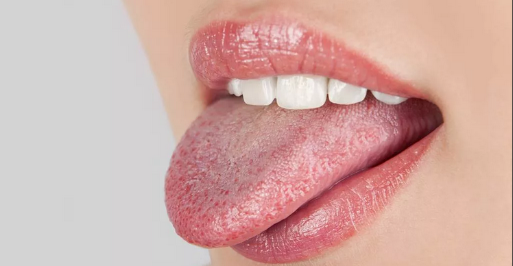 Plak putih di lidah pada orang dewasa