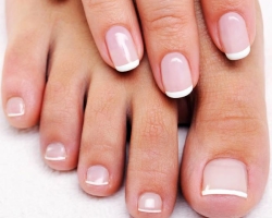 Why do white stripes occur on the nails and legs? What do white strips on the nails mean?