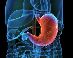 How to reduce the stomach without surgery: diet, exercises and other ways to reduce the stomach. What is the normal volume of the stomach? Causes of stomach stretching. Operation to reduce the stomach: benefit and harm