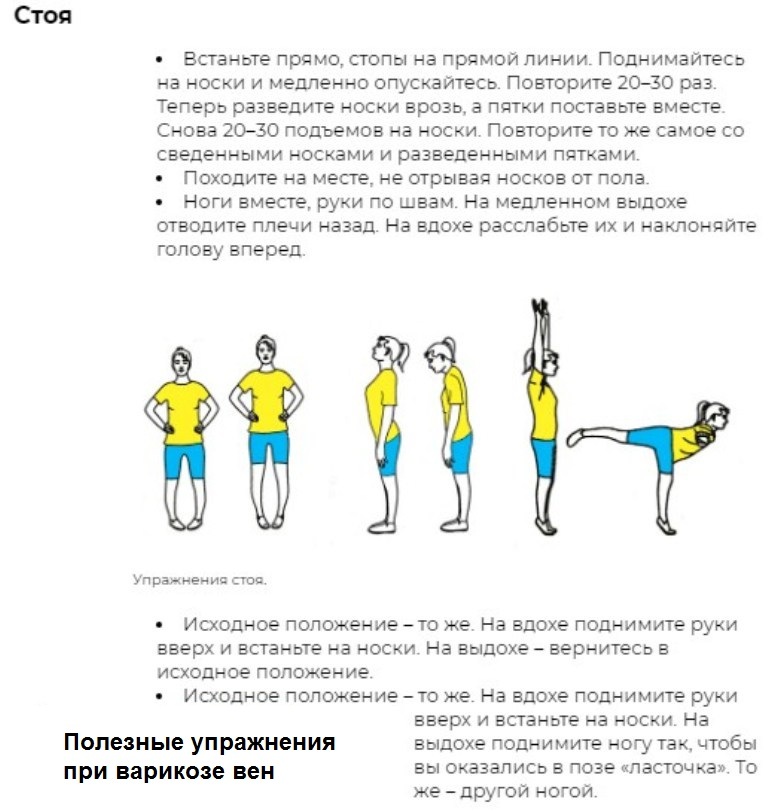 План тренировок при варикозе