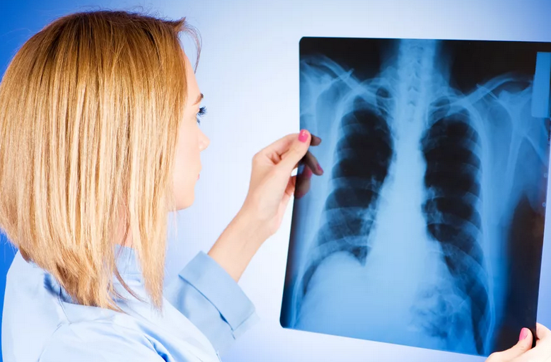 Tuberculosis diagnosis method: X -ray