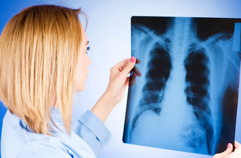 Método de diagnóstico de tuberculosis: X -Ray