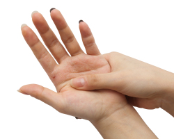 Why does the right hand itch? What signs exist if the right palm itches?