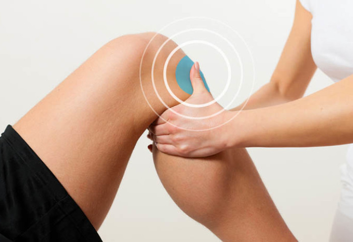 Τύγμα των συνδέσμων της άρθρωσης του γόνατος: φαρμακευτική αγωγή και δημοφιλής θεραπεία