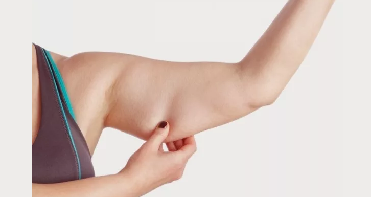 Nackdel i utseendet på en kvinna nr 6, som skrämmer bort män: avsättning av fett i tricepsområdet