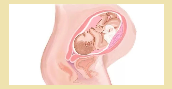 The prolonged pregnancy differs from the transferred