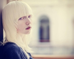 Qui sont des albinos: signes. Combien d'années vivent, pourquoi ne vivent-ils pas longtemps?
