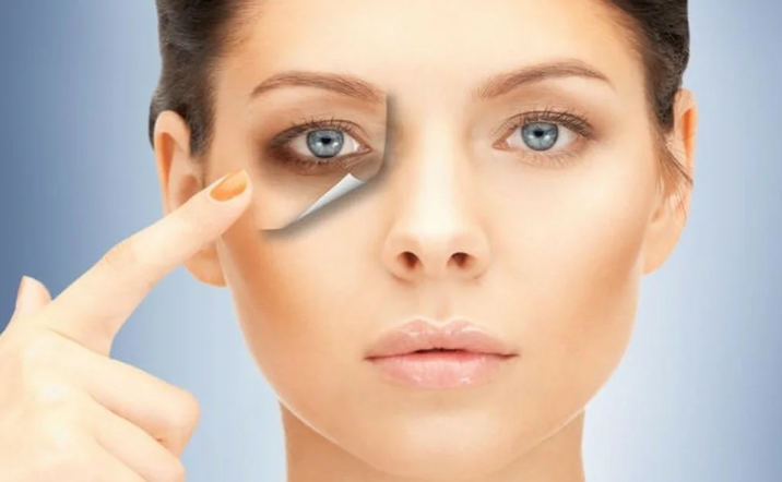 Dark circles under the eyes: state of health in the face