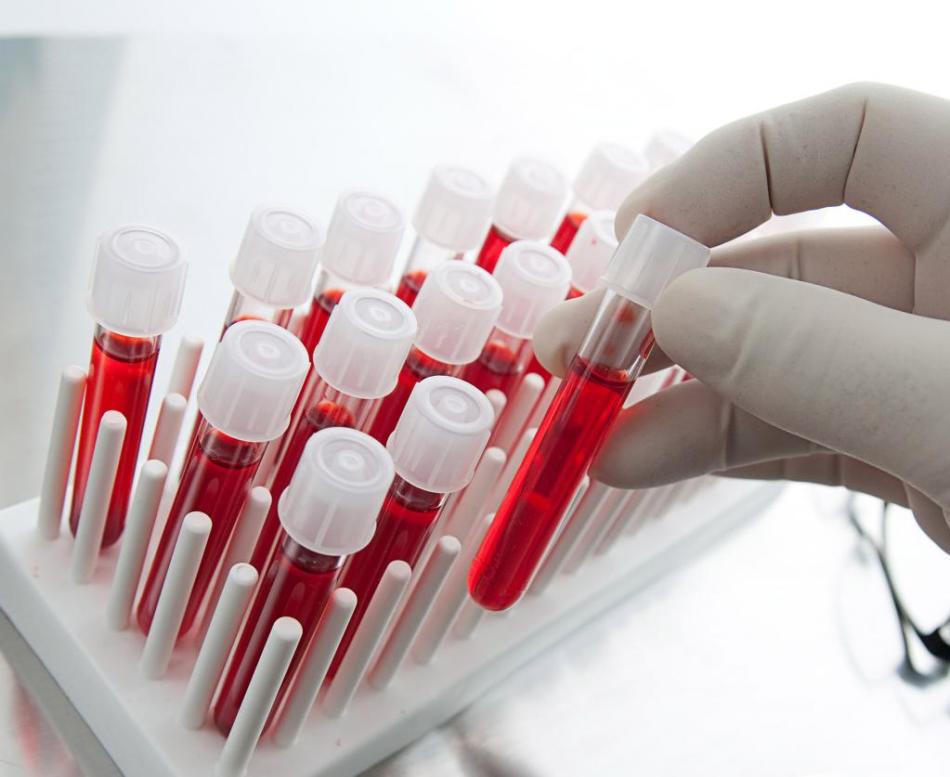 Apa yang mempengaruhi tingkat HCG dalam darah?