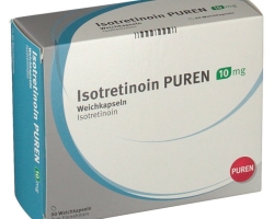 El uso de la isolatinoína en formas de acné severa, acné: efectividad del tratamiento y efectos secundarios