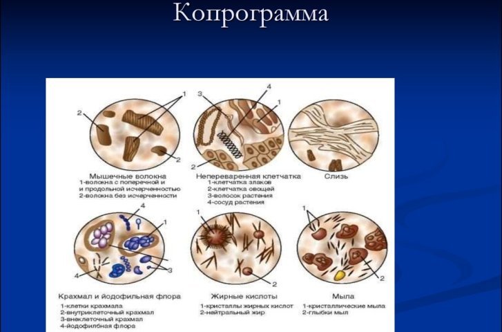 Diagnosis Enteritis Usus Kronis
