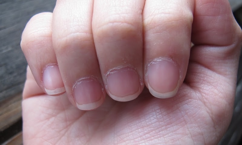 The skin and cuticle on the fingers dry