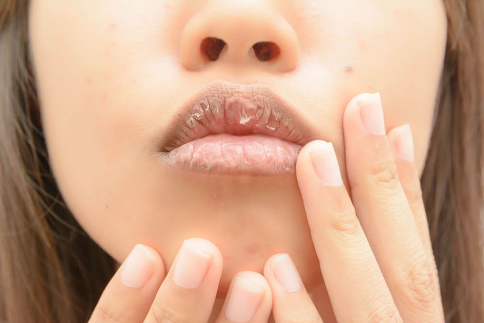 Pourquoi les lèvres sèchent-elles après 40 ans?