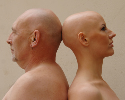 Mi az alopecia férfiakban, nőkben, gyermekekben: tünetek, tünetek, okok, kezelés. Hajhullás: Hogyan lehet megállni?
