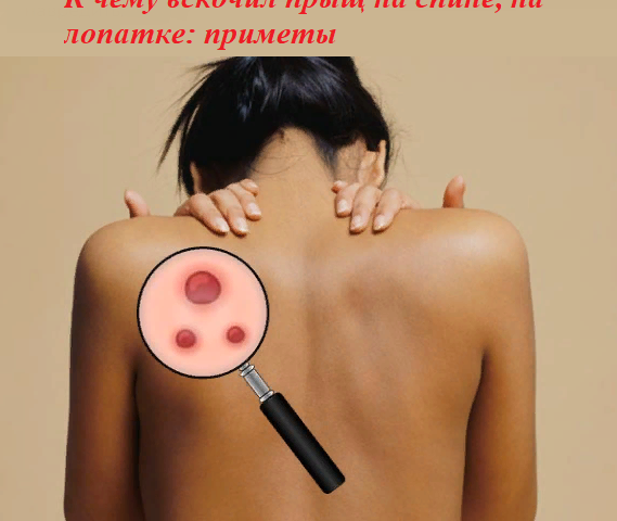 Why the pimple jumped on the back to the right, left, in the center of the back, on the shoulder blade: signs for girls, women and men