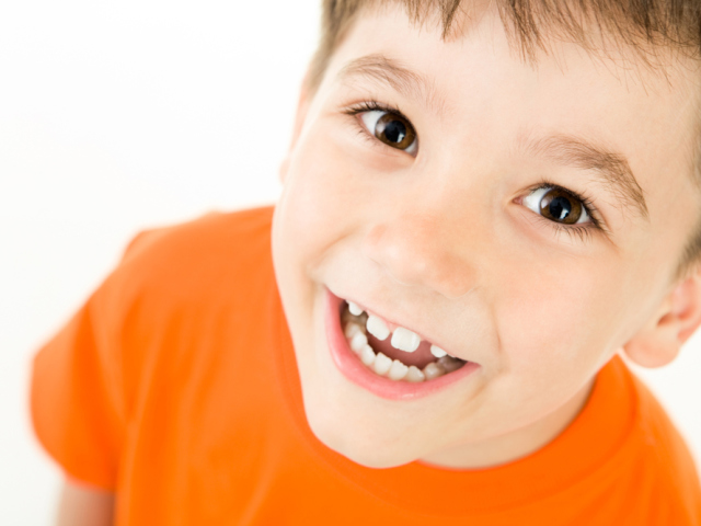 Incorrect bite in a child. How to align your teeth? Aligning tooths with braces, Kappa. Correction of a bite without braces