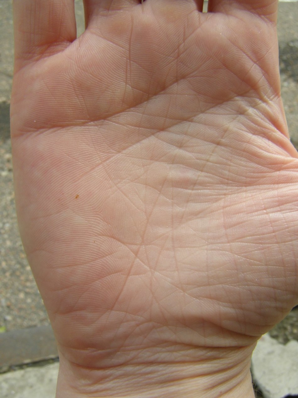 Необычные линии на руке