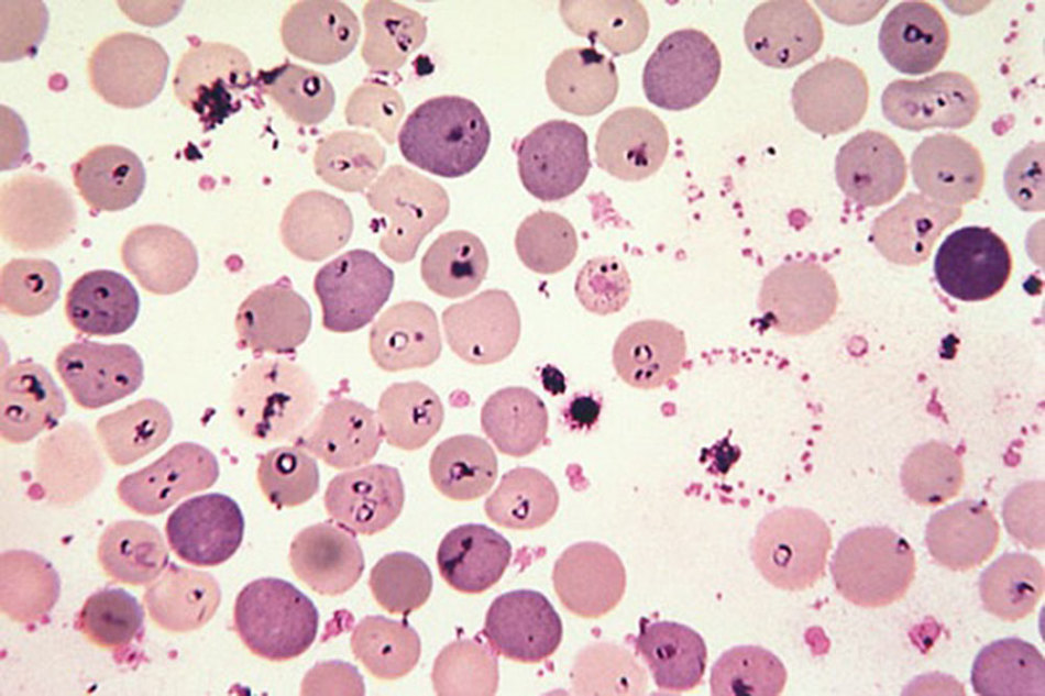 Бабезии в крови под микроскопом