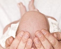 A sárga és a fehér kéreg megjelenésének okai a csecsemő fején? Hogyan lehet gyógyítani a kéreg egy csecsemő fején, hogyan lehet fésülni a kéreg?