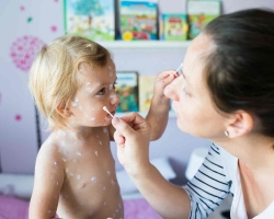 How to knock down the temperature at chickenpox: a list of drugs, folk methods, reviews
