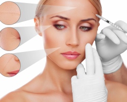 What is face mesotherapy and how is it doing? Methods of mesotherapy of the face