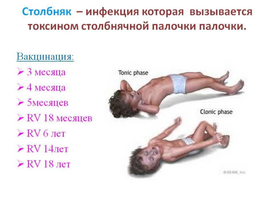 Изображение 5. иммунизация детей против столбняка.