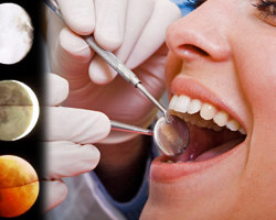 The lunar calendar for the treatment, prosthetics and removal of teeth for 2022-2023: favorable and unfavorable lunar days for treatment, removal, cleaning from stones, bleaching, implantation and prosthetics of teeth in 2022-2023 by month: Table