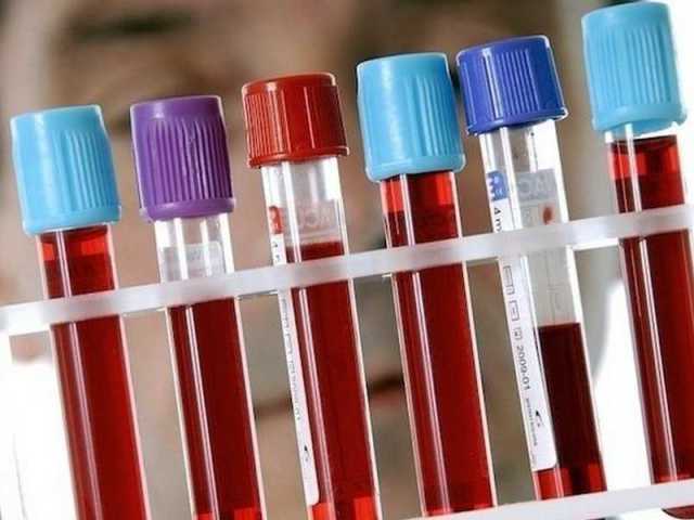 Biokimia Darah - Menguraikan hasil pada orang dewasa, pria, wanita, anak -anak, selama kehamilan: norma dalam tabel. Bagaimana cara mempersiapkan dan melakukan tes darah untuk biokimia dengan benar, berapa hari yang dilakukan di klinik?