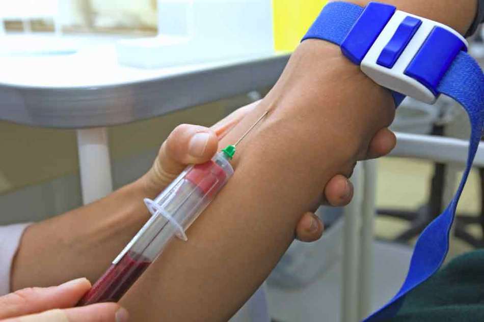 Ali lahko krvni test HCG kaže zunajmaternično nosečnost in kakšna je raven HCG v krvi z zunajmaternično nosečnostjo?