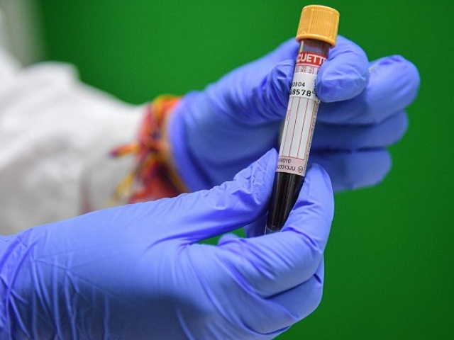 Krvni test za protitelesa, da bi Covid-19 prevzela prazen želodec ali ne? Kako pripraviti na kri na protitelesah na koronavirus?