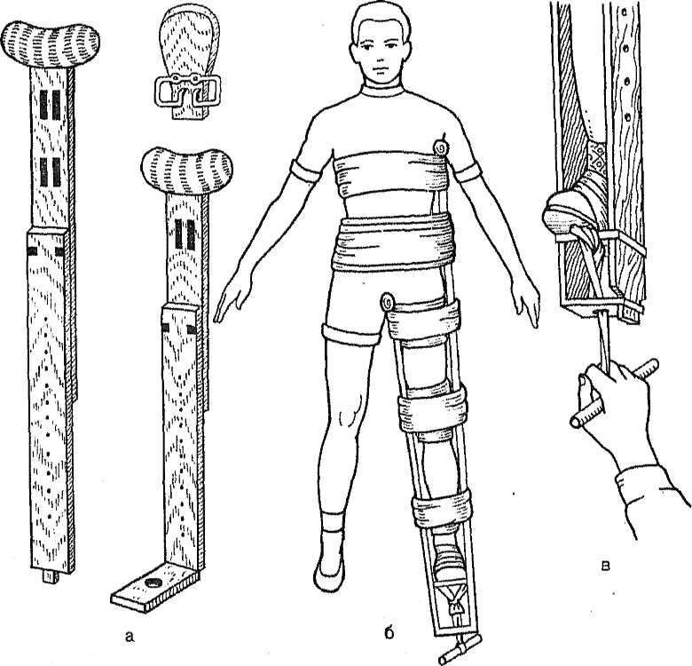 Tire with thigh fracture