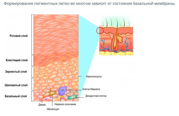 การปรากฏตัวของ hyperpigmentation อาจเป็นเพราะเหตุผลหลายประการ