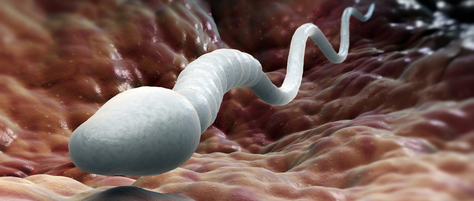 Eden od vzrokov azoospermije je odsotnost aktivne sperme v spermi