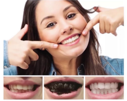How to use activated carbon for teeth whitening: how to clean at home?