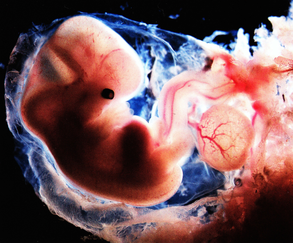 Фото развития ребенка по месяцам в утробе матери