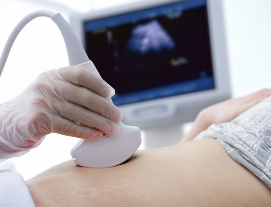 Na ultrazvoku si lahko ogledate Downov sindrom